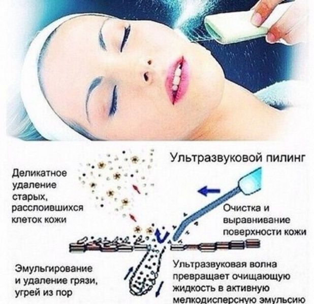 16021 Аппарат ультразвукового пилинга (скраббер) -103 / GT-103 DIY  - Вид №2