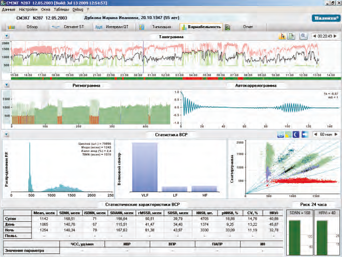 Холтер ЭКГ Валента 12-ти канальный Santreyd MED-37 - Вид №6