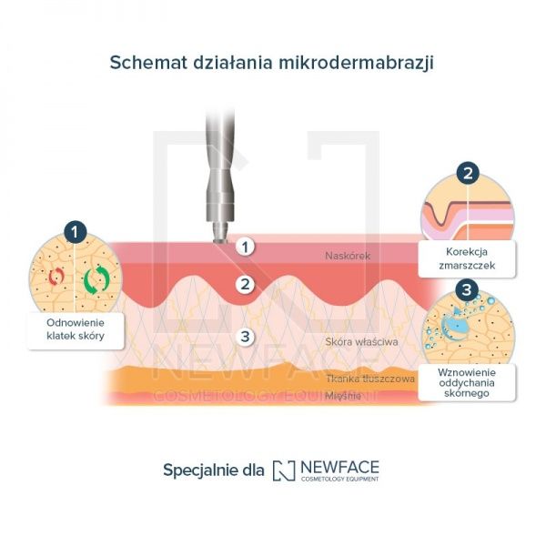 24214 Аппарат алмазной микродермабразии NV-60A / GT-60A Nova NewFace (НОВА НьюФейс)  - Вид №3